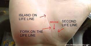 Split Line Of Life Or Marks On The Life Line Palm Reading Charts Palmistry Reading Life Line On Hand