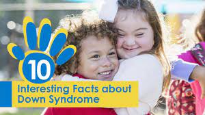 37 Powerful Facts About Down Syndrome Fact Retriever