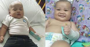 Sebaliknya, disenteri memberi kesan kepada kolon dan menyebabkan mucoid. Anak Muntah Cirit Birit Sampai 2 Minggu Baru Tahu Kuman Ini Penyebabnya Pa Ma