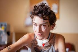 I'm not sure if you guys follow my YouTube channel but this is my good  friend Amber. The withdrawal from tranq was giving her horrible seizures  and she got pneumonia while in