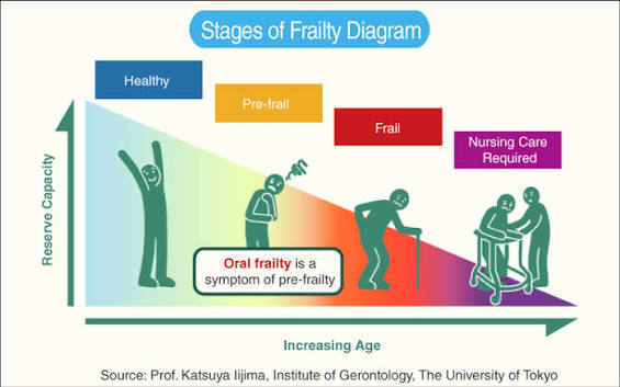 Understand "oral frailty" so that you don't become bedridden | Sunstar Group