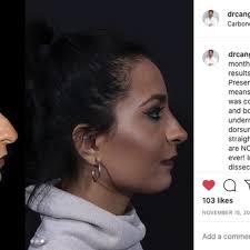 DAVID L. CANGELLO, MD, FACS