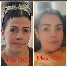 🏴󠁧󠁢󠁳󠁣󠁴󠁿🏴󠁧󠁢󠁳󠁣󠁴󠁿🏴󠁧󠁢󠁳󠁣󠁴󠁿10 years ago I got diagnosed with  MS I wasn't scared I didn't cry why because yes I now have a life long  illness but I'm still breathing an for me it's