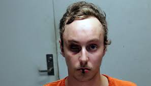 Bond reduced for Altamont man accused of stabbing 16-year-old girl