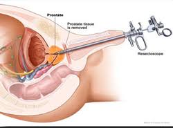 Top 15 cancer surgeons in mumbai are skilled and are practicing since many years. Best Urology Hospitals In India