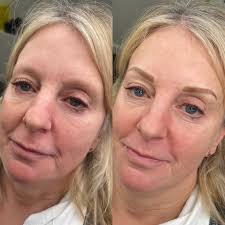 This is a strange request, but if you know Stu Dale can you ask him to  phone Patti 250-666-0505