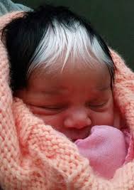 Black Babies Born White Then Turn Black Beautiful Baby Born With A White Patch Of Hair Which Is Exactly The Same As Her Mom S Momlife White Streak In Hair White Hair Beautiful Babies