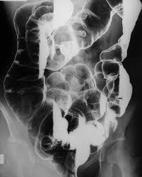 Diagnostic Imaging Of The Abdomen X Ray Ultrasound Ct Mri Diagnostic Imaging X Ray Radiology Technician