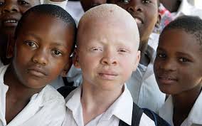 Select from premium tanzania people of the highest quality. Protecting People With Albinism In Tanzania The Borgen Project