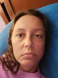 Rescuing an opossum with a traumatic brain injury