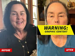 Duck Dynasty' Star Kay Robertson's Brutal Dog Bite Injuries