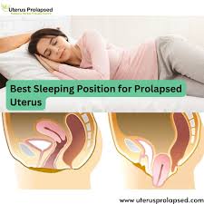 Image result for cervix position