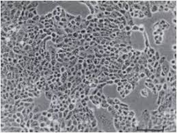 Featured Reagent of the Week Cell Line PEO1 and PEO4 - Ximbio
