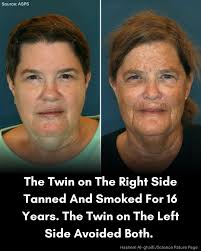Researchers studied 186 pairs of twins to uncover how lifestyle choices  affect perceived age and facial features. They found that twins with a  history of smoking and tanning looked noticeably older than