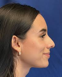 Instagram video by Dr. Mario Botero Ramirez • Nov 28, 2024 at 12:42 PM