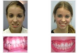 Rural areas can be pricier than large city treatments. Signature Dental Clinic In Petaling Jaya Malaysia Read 63 Reviews