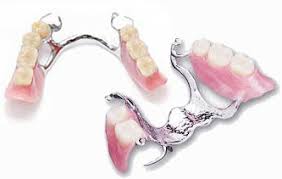 Human jaw layout with ceramic and metal dentures. Metal Dentures Removable Partial Dentures By Prosthodontists