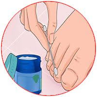 масло чайного дерева от грибка ногтей на ногах отзывы Pin Na Doske Zdorove