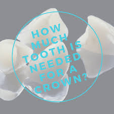 We did not find results for: How Much Tooth Is Needed For A Crown