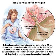 Pacientului i se recomandă o odihnă de pat, o dietă săracă de legume și o băutură caldă abundentă. Viata Cu Reflux Acid Sau Boala De Reflux Gastroesofagian Lungul Drum Pana Departe