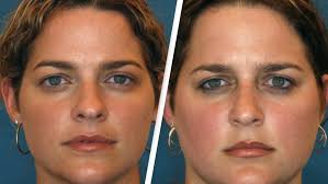 Twins Timothy and Lydia Ridgeway, born from 30-year-old frozen embryos,  have just turned one