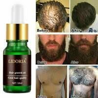 You can nourish your hair from the inside with vitamins tho. 20ml Rebrote De Cabello Crecimiento Denso Aceite De Jengibre Suero Anti Perdida Esencia Spray 2021 Ebay