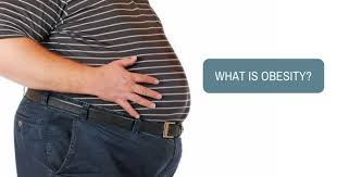 Image result for Obesity