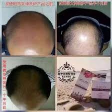 The company's current operating status is cancelled. Aisan Top Team Shampoo Topteamshampoo Profile Pinterest