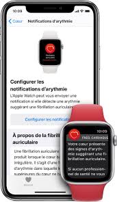 L'ablation par cathéter est une intervention peu effractive qui pourrait diminuer le nombre d'épisodes de fibrillation auriculaire ou la traiter. Temoignage Lorsque L Apple Watch Alerte D Une Fibrillation Auriculaire Insoupconnee Watchgeneration