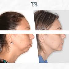 Dr Daniel Negrelle (@dr_danielnegrelle) · Curitiba, PR