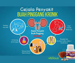 13 gejala hiv aids pada pria patut diwaspadai. Sihat Badan 2 0 Gejala Penyakit Buah Pinggang Kronik Facebook