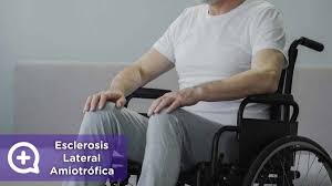 Ela o esclerosis lateral amiotrófica es una enfermedad del sistema nervioso central. Que Es La Ela Una Dolencia Incurable Hoy En Dia Mediquo