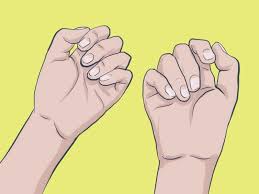 D.) chronic dry cuticles or skin around nail chronic dry skin does not heal easily and can predispose the sufferer to secondary infections. 6 Ways To Stop Biting Your Nails Wikihow
