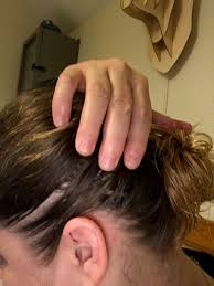 A checklist of skin, hair, and nail changes although your thyroid gland sits deep in your neck, your dermatologist may be the first doctor to notice signs of thyroid disease. Is Seeing A Trichologist For Hair Loss Worth It Thyroid Uk