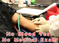 In addition to asking about your medical history (including smoking history), they may test your blood and urine for common health conditions that can put you at increased risk of mortality. Term Life Insurance No Medical Exams No Doctor Physical Or Blood Tests