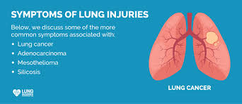 Know about lung cancer symptoms early and get a proper given below are some lung cancer symptoms. Symptoms Of Lung Injuries Lung Injuries