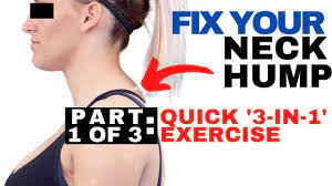 Maybe you would like to learn more about one of these? Neck Hump Fix Chiropractic On Eagle Dr Jon Saunders