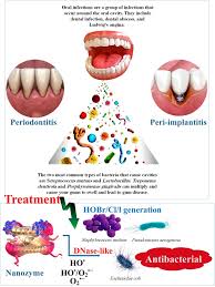 The potential use of nanozymes as an antibacterial agents in oral  infection, periodontitis, and peri-implantitis