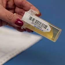 Rapid lateral flow tests use a device similar to a pregnancy test to give a quick result. How Long Does It Take To Get Drug Test Results Usa Mobile Drug Testing Of Northeast Ohio