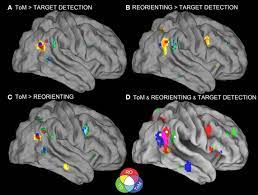 What does rtpj stand for? Frontiers Rethinking The Role Of The Rtpj In Attention And Social Cognition In Light Of The Opposing Domains Hypothesis Findings From An Ale Based Meta Analysis And Resting State Functional Connectivity Human Neuroscience