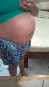 Barriga Alta E Mole Em Baixo Alguem Marco De 2016 Babycenter