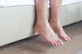 Image result for Pigment stains on the shin