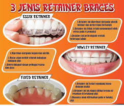 Q&M Dental Clinic - Tun Aminah (Invisalign Braces Provider)