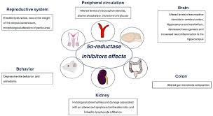 Finasteride only prevents dht derived hair loss. Side Effects Of Treatment With 5 Alpha Reductase Inhibitors In Download Scientific Diagram