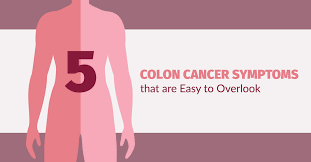 Many people with colon cancer don't have symptoms. 5 Colon Cancer Symptoms That Are Easy To Overlook
