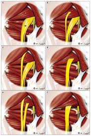 Deep Gluteal Space Problems Piriformis Syndrome Ischiofemoral Impingement And Sciatic Nerve Release Abstract Europe Pmc