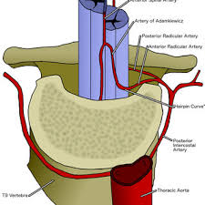 An artery (plural arteries) (from greek ἀρτηρία (artēria) 'windpipe, artery')1 is a the anatomy of arteries can be separated into gross anatomy, at the macroscopic level, and microanatomy diagram showing the effects of atherosclerosis on an artery. Pdf The Artery Of Adamkiewicz Vascular Anatomy Clinical Significance And Surgical Considerations