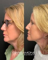 Ralph Garramone, Plastic Surgeon and Medi-Spa