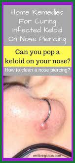10 Natural Home Remedies For Curing Infected Keloid On Nose Piercing How To Get Rid Of A Bu How To Get Rid Of A Gesichtspiercing Nasenpiercing Piercings