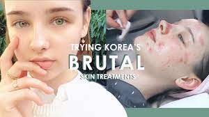 Gratis versand in 24 h bereits ab 20€. My First Brutal Korean Dermatology Experience Banobagi Laser Treatments Sissel Youtube